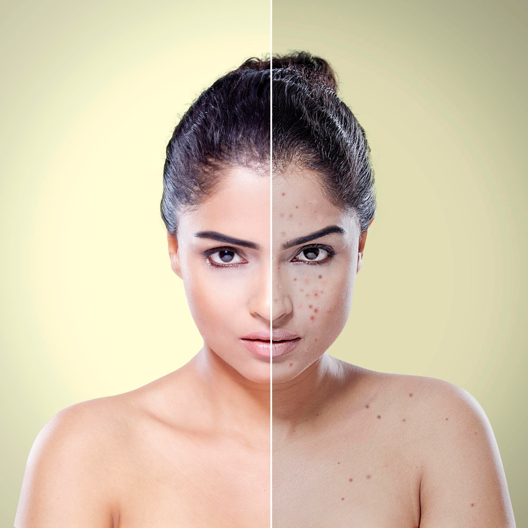 Exfoliate and Refresh